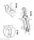 Fig. 22 - Surgical fastener applying apparatus
