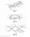 Fig. 06 - Surgical stapling apparatus including buttress attachment