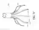 Fig. 43 - TISSUE GATHERING BASKET ENHANCEMENTS