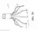 Fig. 44 - TISSUE GATHERING BASKET ENHANCEMENTS