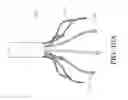 Fig. 50 - TISSUE GATHERING BASKET ENHANCEMENTS