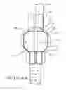 Fig. 07 - ENDOLUMENAL RESTRICTION METHOD AND APPARATUS