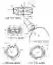 Fig. 16 - ENDOLUMENAL RESTRICTION METHOD AND APPARATUS