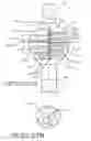 Fig. 23 - ENDOLUMENAL RESTRICTION METHOD AND APPARATUS