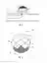 Fig. 02 - Occlusive devices
