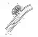 Fig. 01 - Detachable tip microcatheter