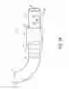 Fig. 03 - Detachable tip microcatheter