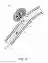 Fig. 06 - Detachable tip microcatheter