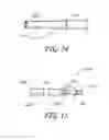 Fig. 15 - Detachable tip microcatheter