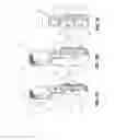Fig. 04 - Vetebral osteotomy saw guide