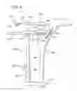 Fig. 08 - METHOD AND APPARATUS FOR FEMORAL RESECTION ALIGNMENT