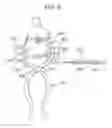 Fig. 09 - METHOD AND APPARATUS FOR FEMORAL RESECTION ALIGNMENT