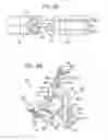 Fig. 19 - METHOD AND APPARATUS FOR FEMORAL RESECTION ALIGNMENT
