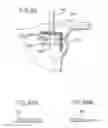 Fig. 26 - METHOD AND APPARATUS FOR FEMORAL RESECTION ALIGNMENT