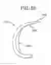 Fig. 41 - METHOD AND APPARATUS FOR FEMORAL RESECTION ALIGNMENT