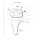 Fig. 45 - METHOD AND APPARATUS FOR FEMORAL RESECTION ALIGNMENT