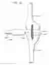 Fig. 46 - METHOD AND APPARATUS FOR FEMORAL RESECTION ALIGNMENT