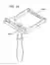 Fig. 56 - METHOD AND APPARATUS FOR FEMORAL RESECTION ALIGNMENT