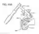 Fig. 58 - METHOD AND APPARATUS FOR FEMORAL RESECTION ALIGNMENT