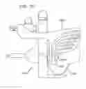 Fig. 70 - METHOD AND APPARATUS FOR FEMORAL RESECTION ALIGNMENT