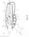 Fig. 06 - Retraction and aspiration device for treating embolism and associated systems and methods