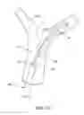 Fig. 09 - Retraction and aspiration device for treating embolism and associated systems and methods