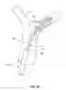 Fig. 11 - Retraction and aspiration device for treating embolism and associated systems and methods