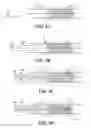 Fig. 17 - Retraction and aspiration device for treating embolism and associated systems and methods