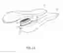Fig. 02 - HAND HELD DERMAPLANING DEVICE AND METHOD FOR USING SAME