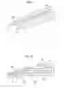 Fig. 08 - TREATMENT TOOL