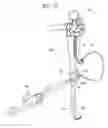 Fig. 09 - TREATMENT TOOL