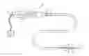 Fig. 01 - Intravascular catheter having an expandable incising portion and medication delivery system