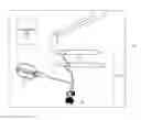 Fig. 01 - Method of implanting a penile prosthetic