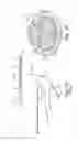 Fig. 02 - Method of implanting a penile prosthetic
