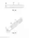 Fig. 02 - Dynamic decompressive craniotomy fixation devices and related methods