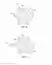 Fig. 04 - Dynamic decompressive craniotomy fixation devices and related methods