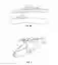 Fig. 10 - Dynamic decompressive craniotomy fixation devices and related methods