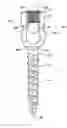 Fig. 01 - Pedicle screw fixation system and method for use of same