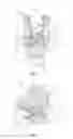 Fig. 10 - Spinal implant system and methods of use