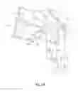 Fig. 05 - INTERSPINOUS PROCESS DEVICE