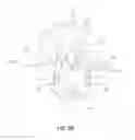 Fig. 06 - INTERSPINOUS PROCESS DEVICE