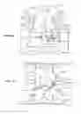 Fig. 14 - Lateral spinous process spacer