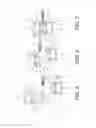 Fig. 06 - Spinous process fixation system and methods thereof