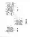 Fig. 07 - Spinous process fixation system and methods thereof
