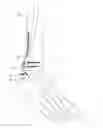 Fig. 01 - Flexible bone implant