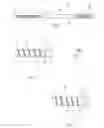 Fig. 02 - Flexible bone implant