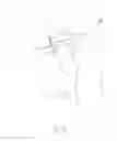 Fig. 05 - Flexible bone implant