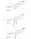 Fig. 10 - Flexible bone implant