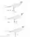 Fig. 11 - Flexible bone implant