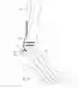 Fig. 19 - Flexible bone implant